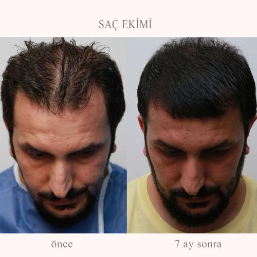 наших пациентов 2